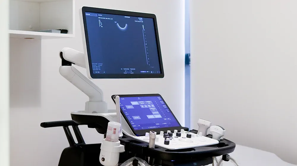 Aparelho de ultrassom usado nos exames da Ultra Imagem Diagnósticos